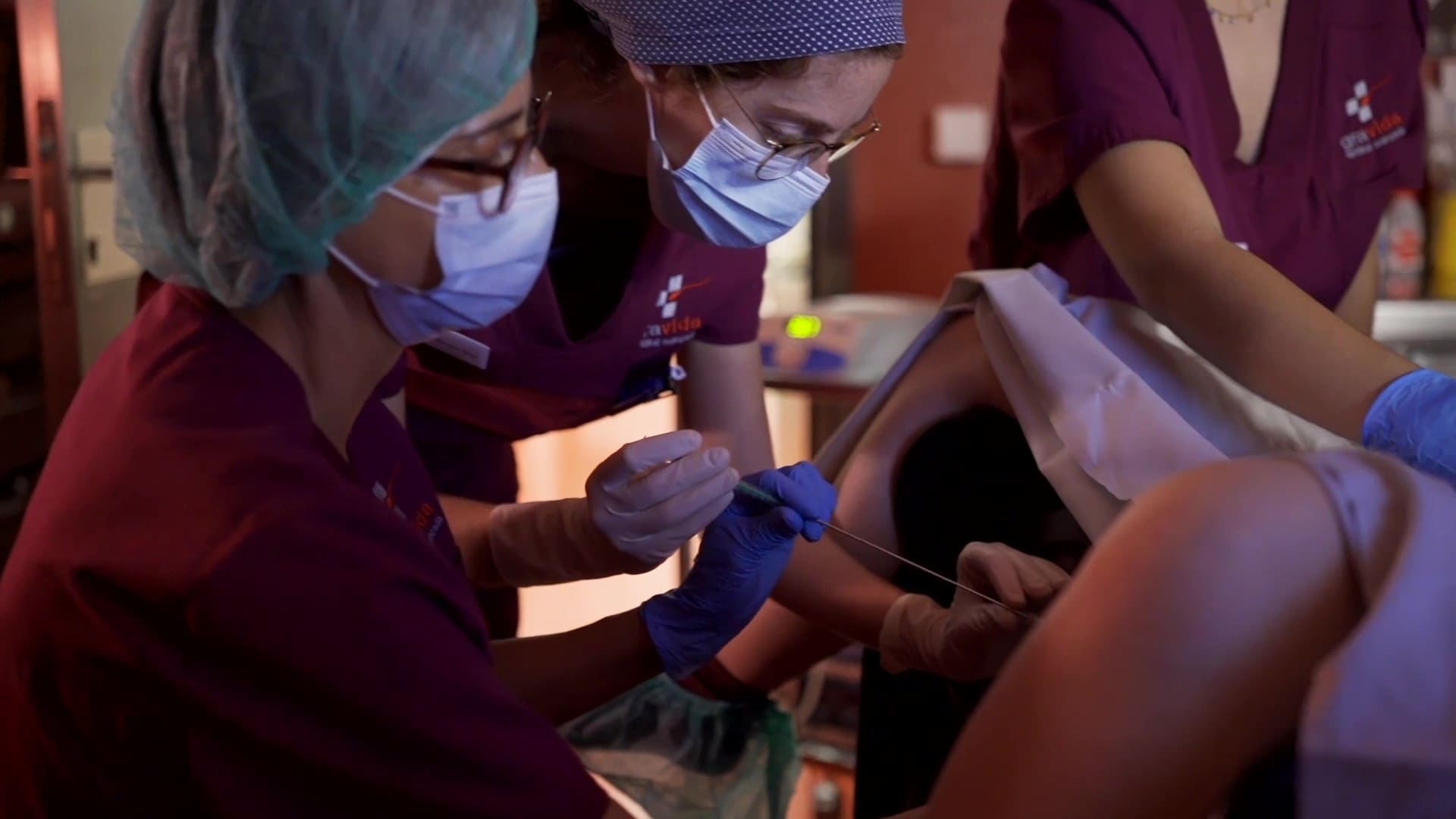 Momento de la transferencia embrionaria donde ginecóloga y embrióloga depositan el embrión en el útero.

En el método ROPA, una de las pacientes se somete a la punción folicular para obtener los óvulos y la otra paciente recibe el embrión resultante de fecundar los óvulos de su pareja con semen de donante.