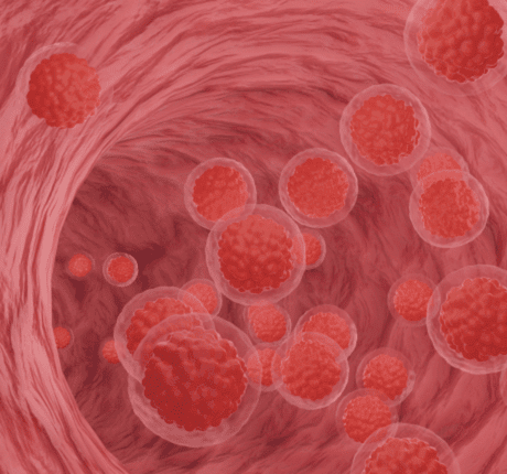 Disegno di una sezione trasversale di un cordone ombelicale in cui circolano più globuli rossi. Nella diagnosi genetica preimpianto (DGP) per istocompatibilità, vengono selezionati embrioni compatibili per curare altri fratelli affetti dalla malattia.