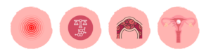 Cuatro iconos representando los efectos de las enfermedades autoinmunes en la fertilidad: inflamación, desregulación hormonal, problemas de coagulación y dificultades en la implantación del embrión.