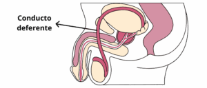 Ilustración médica del aparato reproductor masculino con el conducto deferente señalado, que transporta los espermatozoides desde el testículo hasta la uretra