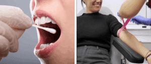 Extracción de muestra de saliva y análisis de sangre para realizar el test de compatibilidad genética en reproducción asistida
